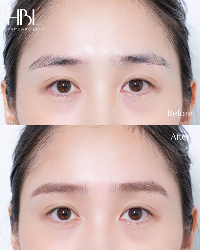Before / Afterの画像。毛流れの変化やワックス後のきれいな仕上がり写真。